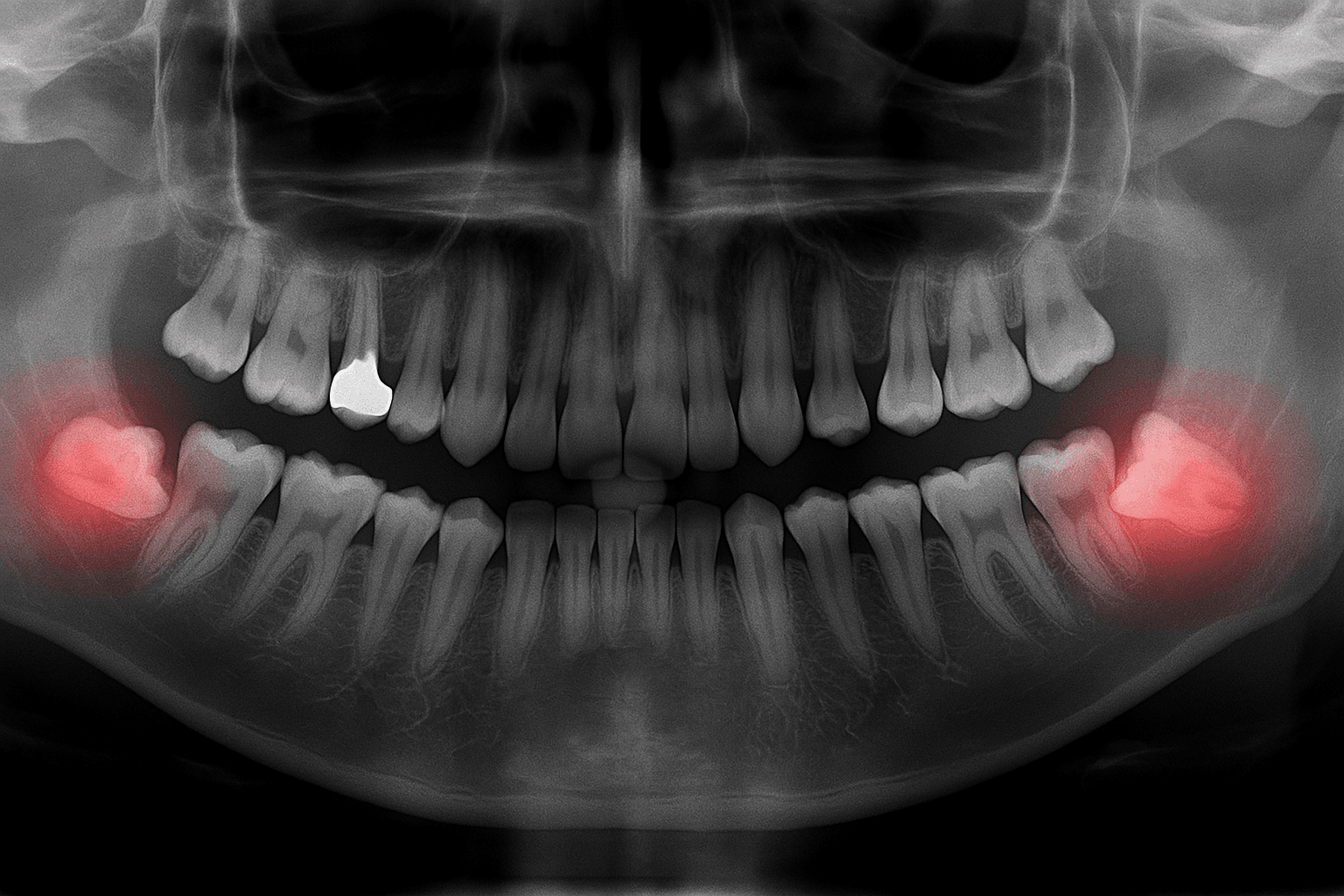 Chirurgia stomatologiczna
