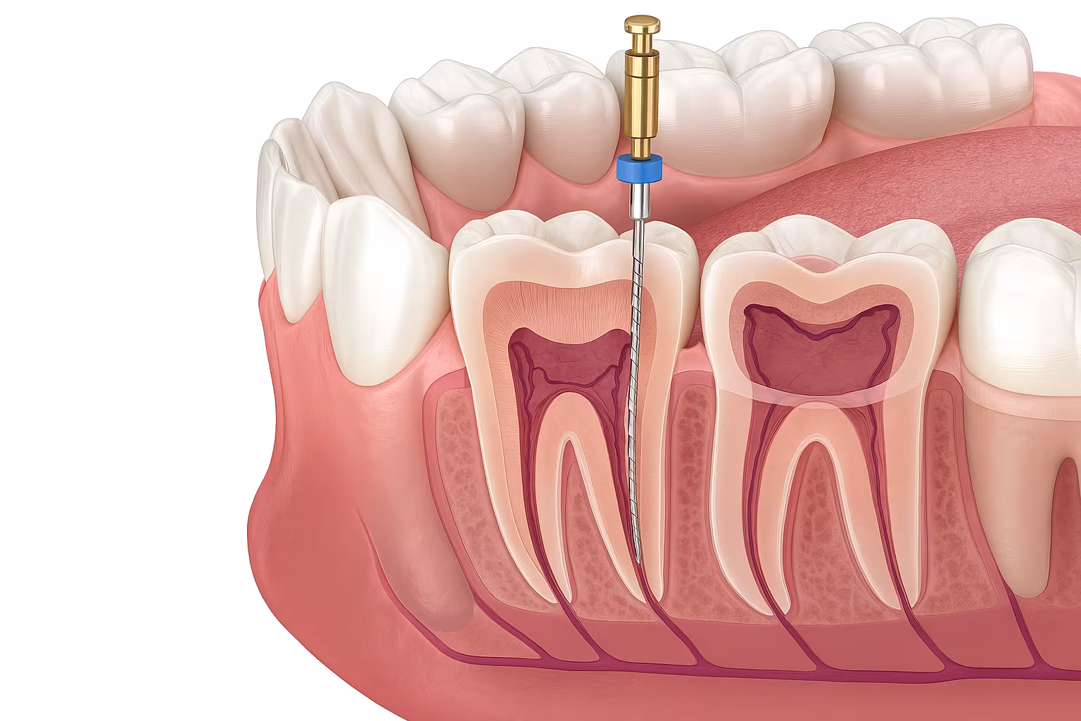 Endodoncja - Usługi stomatologiczne Olsztyn